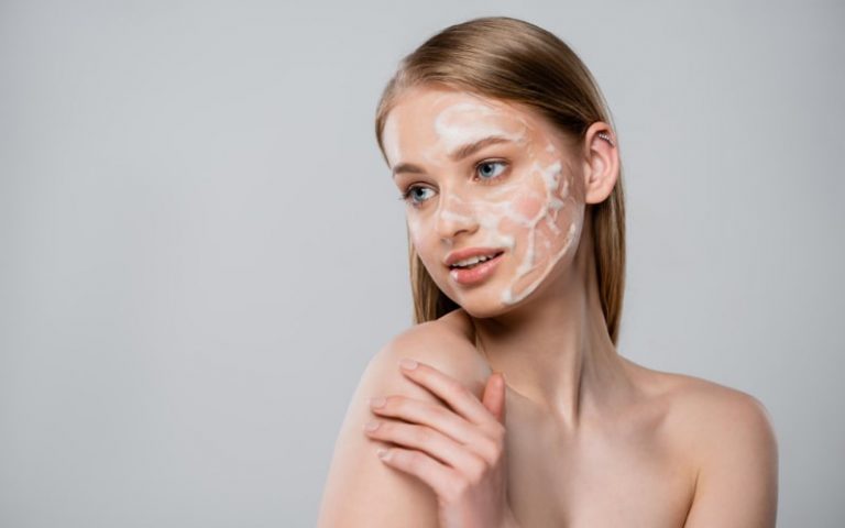 Beneficios del peeling químico