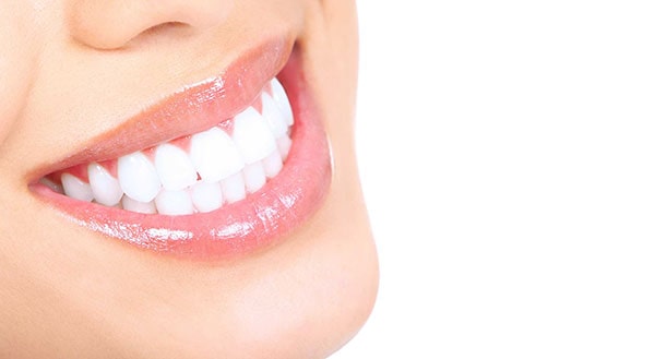 Tratamiento Sonrisa Gingival en Manresa